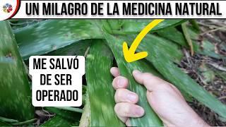  Los MOTIVOS por los que TODOS están BUSCANDO ALOE VERA para su casa  Es una PLANTA MILAGROSA