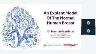 VitroGel Hydrogel Helps in Novel Pre-Clinical Model of the Normal Human Breast -Dr. Hannah Harrison