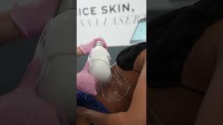 Freeze away fat with minimal to no downtime!
