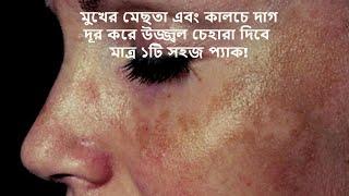 মুখের মেছতা দূর করার উপায় কি?