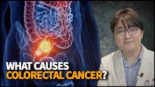 Colorectal Cancer | CloudHospital TV