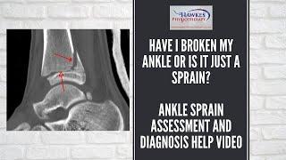 Have I broken my ankle or is it just a sprain: Ankle sprain assessment and diagnosis help video