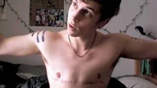 two years post top surgery!