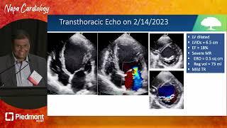 Severe Functional Mitral Regurgitation