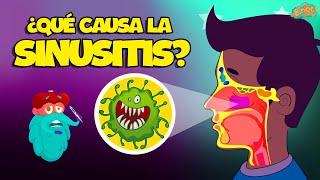 ¿Qué Causa La Sinusitis? | Ciencias Cara Niños | Vídeo educativo | Educativos Para Niños 2024