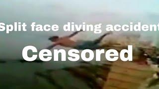 Split face diving accident (CENSORED)