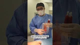 Penis enlargement surgery and Stem cell therapy Dr Araz Bayramov Penis surgery penilenlargement.com