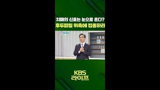 치매의 신호는 눈으로 온다?  후두피질 위축에 집중하라! ️ [무엇이든 물어보세요] | KBS 방송