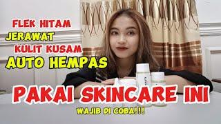 FLEK HITAM DAN JERAWAT AUTO HEMPAS PAKAI SKINCARE INI  WAJIB DICOBA ‼️