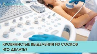 Кровянистые выделения из сосков. Лечение рака по ОМС в клинике Дружковых. Звоните 8 (800) 550-71-67.