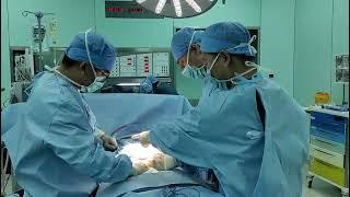 Video: instructing visiting doctors to perform lower abdominal liposuction 视频分享：指导进修医生进行下腹部吸脂