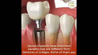 Best Dental Clinic in Indore for Dental Implant