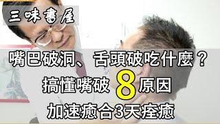 嘴巴破洞、舌頭破吃什麼可以快點好？搞懂嘴破8種原因加速癒合/三味書屋