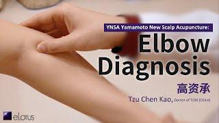 YNSA Yamamoto New Scalp Acupuncture: Elbow Diagnosis