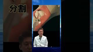 おやしらずの抜歯は大変なんです #親知らず #歯列矯正 #蒲田 #歯医者 #矯正