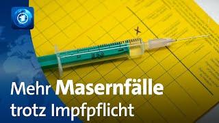 Viele Masernfälle in Deutschland