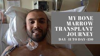 My Bone Marrow Transplant Journey | Day -11 to Day +150 | Vlog | Leukaemia |AML | Cancer |