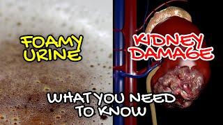 Is foamy urine damage kidney? | Health Educare