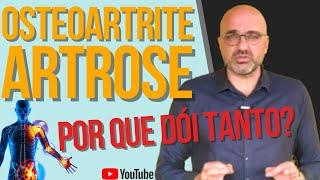 7 coisas que VOCÊ precisa SABER sobre ARTROSE / OSTEOARTRITE