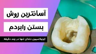 روش سریع و آسان بستن رابردم برای بیماران دندانپزشکی