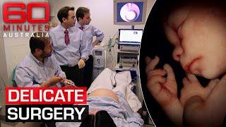 Saving precious young lives before they're born | 60 Minutes Australia