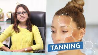 Tanning | Dr. Deepika Lunawat