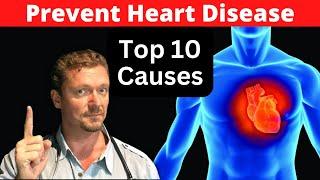 This One Trick Prevents Heart Attacks (Top 10 Risks for CAD) 2024