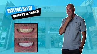 Get Zirconium Crowns / Full Veneers in Turkey | Interview with Paul | New Teeth and Smile