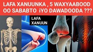 #LAFA-XANUUNKA#5 WAXYAABOOD OO SABABTO LAFA XANUUNKA IYO DAAWADOODA ??