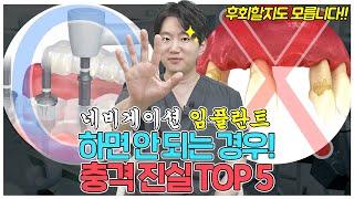 네비게이션 임플란트는 광고처럼 장점만 있을까? l 네비게이션 임플란트의 충격적인 진실 TOP 5