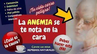 ¡ANEMIA! ¡TU VIDA ESTÁ EL PELIGRO! ESTOS SON LOS SÍNTOMAS Y EL REMEDIO NATURAL PARA CURARLA