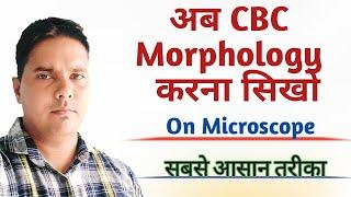 अब CBC Morphology करना सिखो | RBC morphology in hindi | RBC under microscope