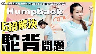 駝背問題6招解決| 快速瘦背！| Stretching and muscle exercise for  Humpback | Keep Fit and Beauty|＃駝背 ＃humpback