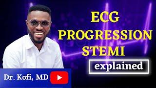 Evolution of ECG changes in STEMI simplified - #EKGsimplified #electrocardiogram #usmle #gmdc #plab