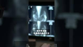 新州政府呼吁: 这个年龄段女性 应尽快进行乳腺检查  | SBS中文 #shorts