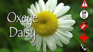 Oxeye Daisy: Edible, Medicinal, Cautions & Other Uses