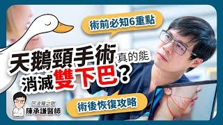 天鵝頸手術真的能消滅雙下巴？術前必知6重點與術後恢復攻略 | 陳承謙醫師