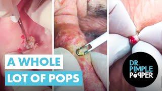 A Whole Lot of Pops