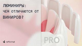  Люминиры: чем отличаются от виниров?