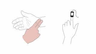 Mastering transcutaneous pacing