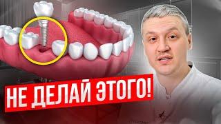 КОМУ НЕЛЬЗЯ ставить ЗУБНЫЕ ИМПЛАНТЫ? Плюсы, минусы и противопоказания от стоматолога!