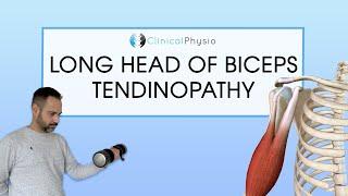 Long Head Biceps Tendinopathy | Expert Physio Review