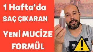 Saçlarım Yeniden Çıktı - Saç Çıkaran Mucize Doğal Kür