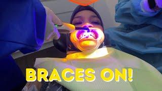 I GOT MY BRACES ON! | Malaysia