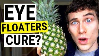 Eye Floaters No More! New (Natural) Eye Floaters Treatment Research | Doctor Eye Health