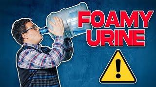 Can Drinking too Much Water Cause a Foamy Urine