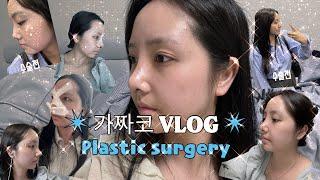 [Vlog]코수술브이로그｜직장인코수술｜가짜코브이로그｜1일차~10일차 기록(부산 코수술, 코수술 전/후, 붓기관리, 붓기템)