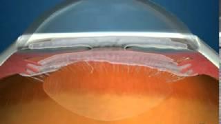 How Fluid Circulates in the Eye