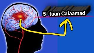 Ka hor inta maskaxda dhiig ku furmin ama ka xermin 5-taan Calaamad ayuu qofka isku arki karaa Ama...