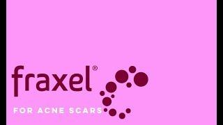 Fraxel  Dual Laser l Total Dermatology